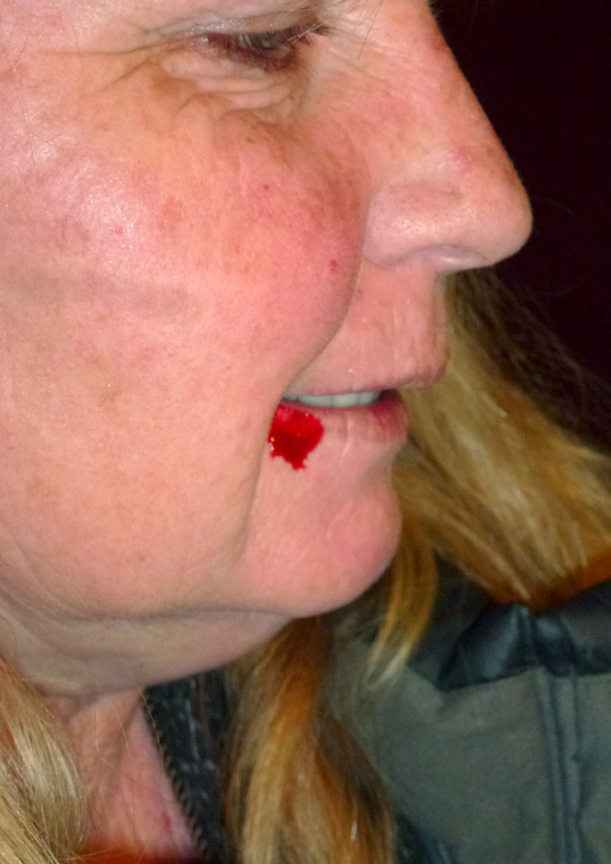 But I didn't get off so lightly myself...