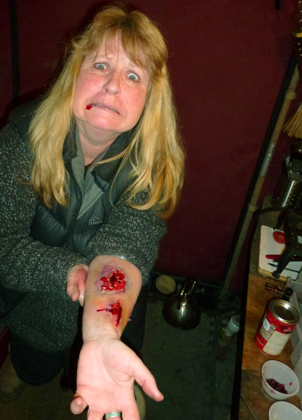 I think I might have nicked a lung...